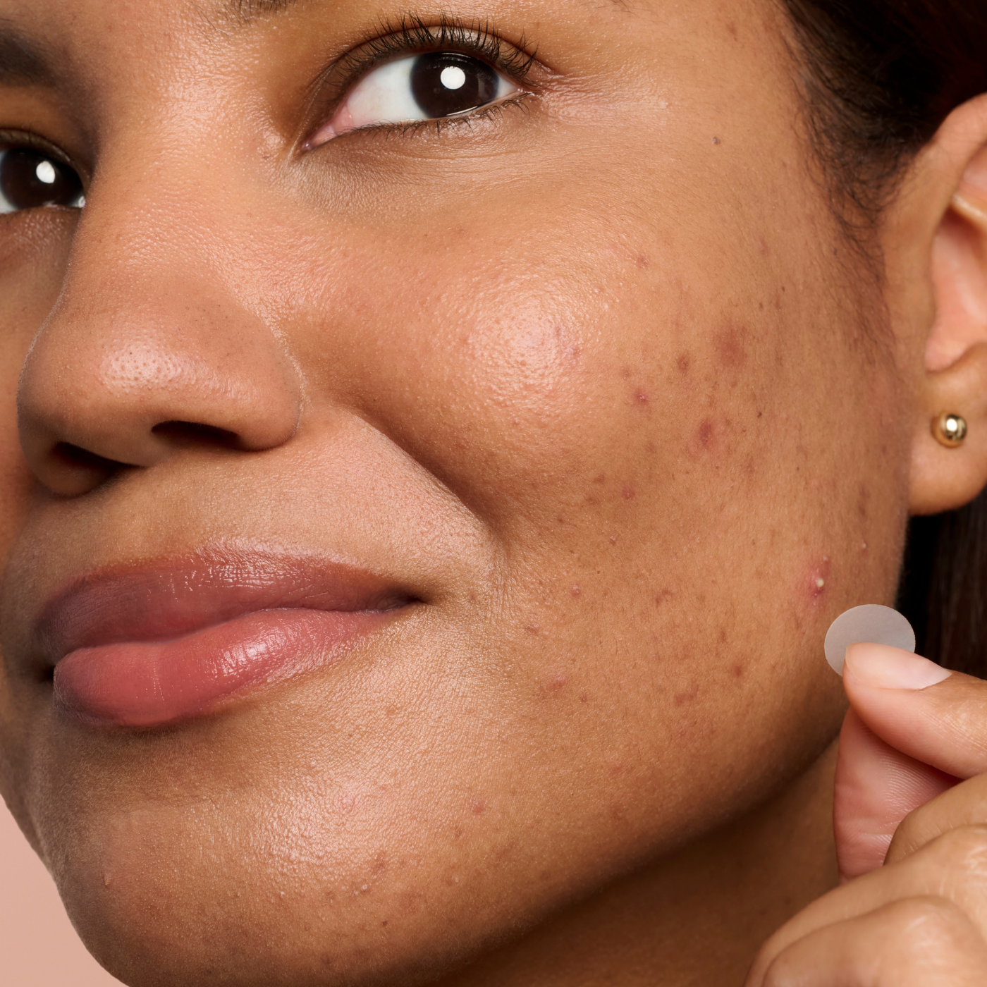 Blemish Control Duo - Calm Repair