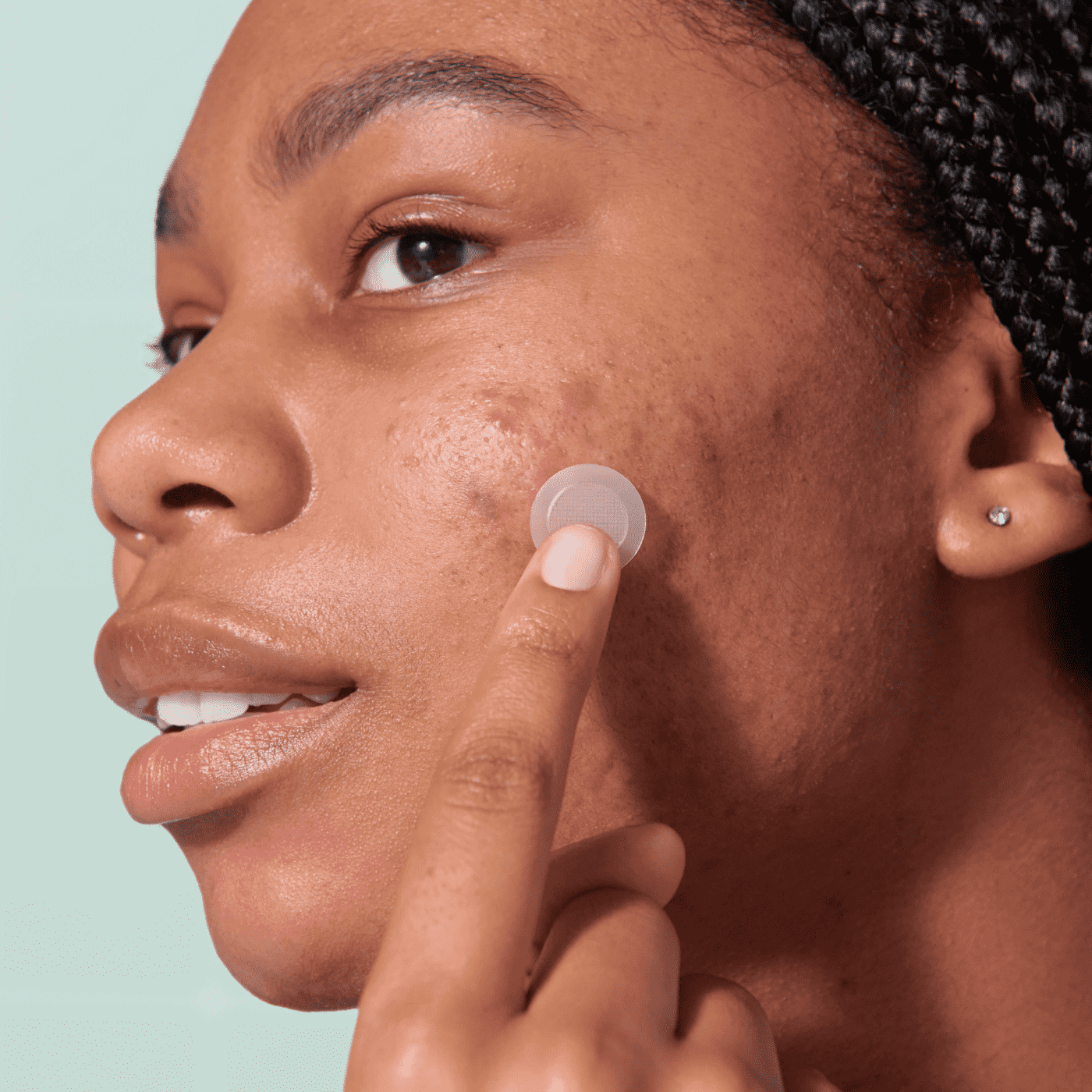 Mighty Patch™ for Early-Stage Blemishes - First Sign Care