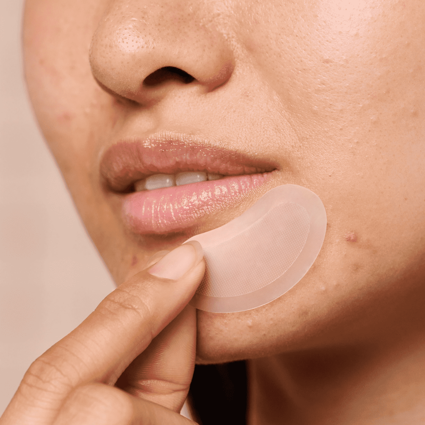 Mighty Patch™ for XL Early-Stage Blemishes - Fast Rescue