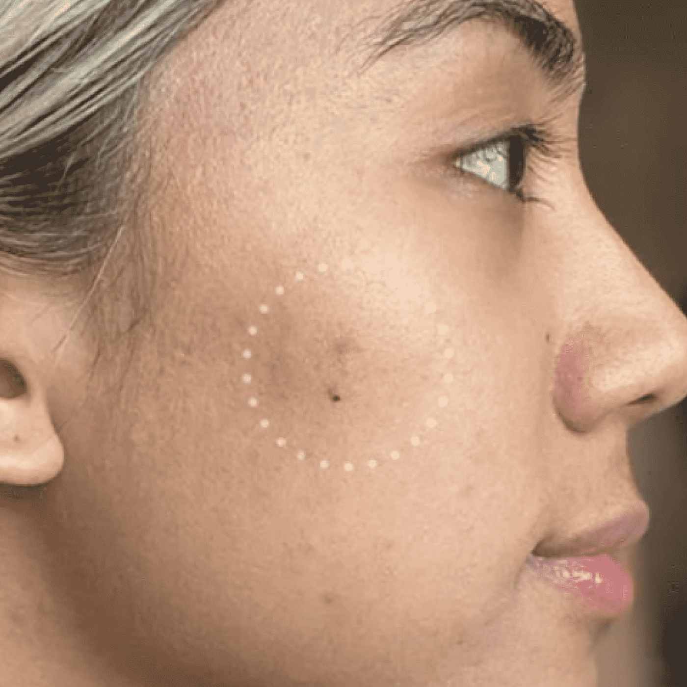 Mighty Patch™ for Dark Spots - Spot Bright