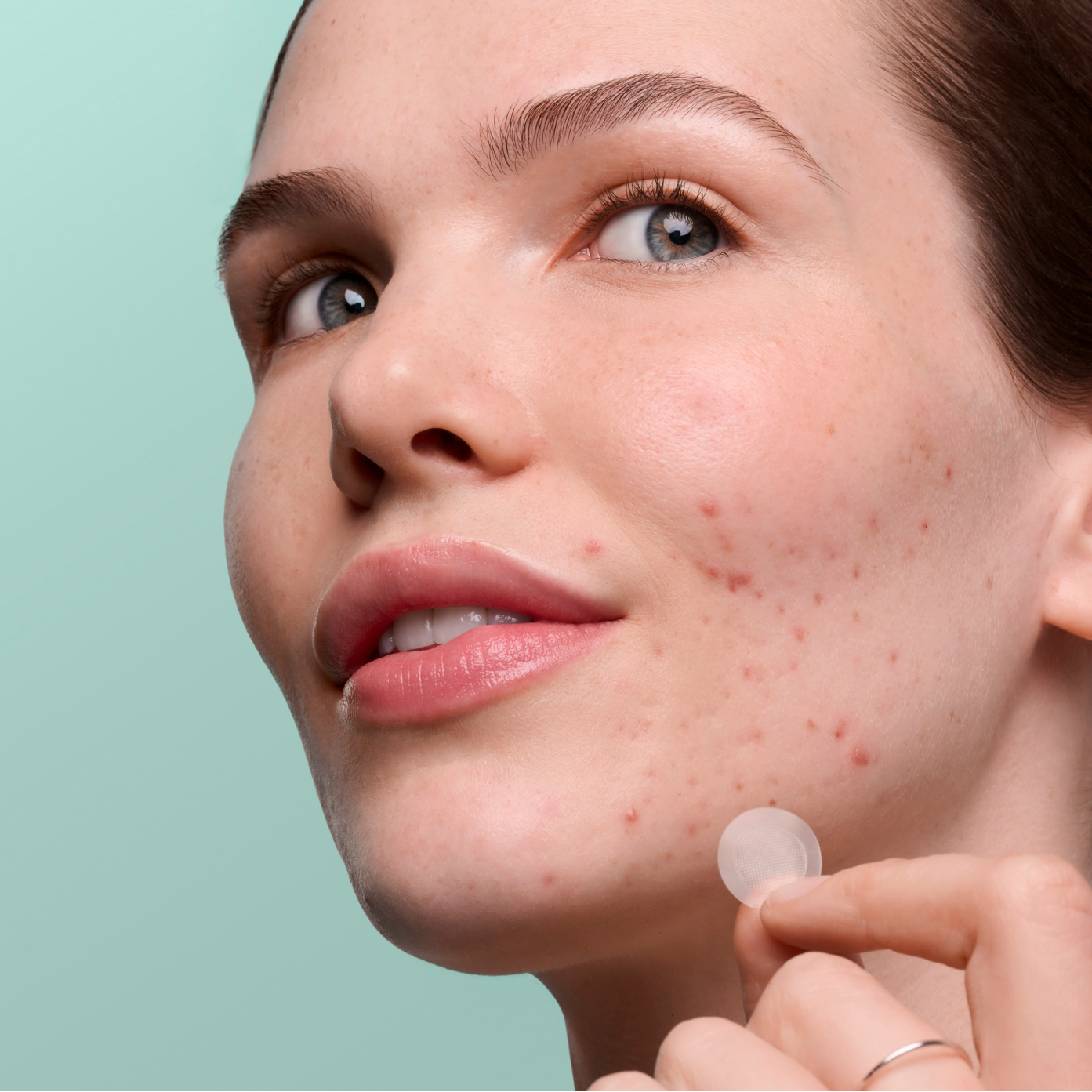 Pimple Patrol Duo - Daily Rescue